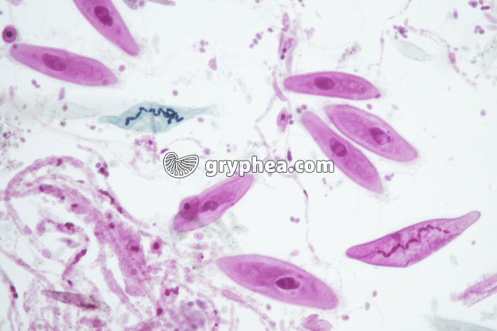 Protozoaires divers (mélange) x40 - gryphea.org